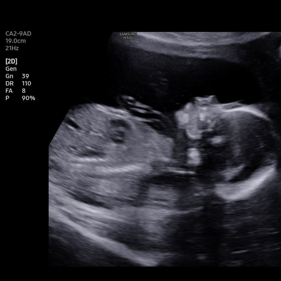 Photo shared by Kaitlyn for their Babylist baby registry.