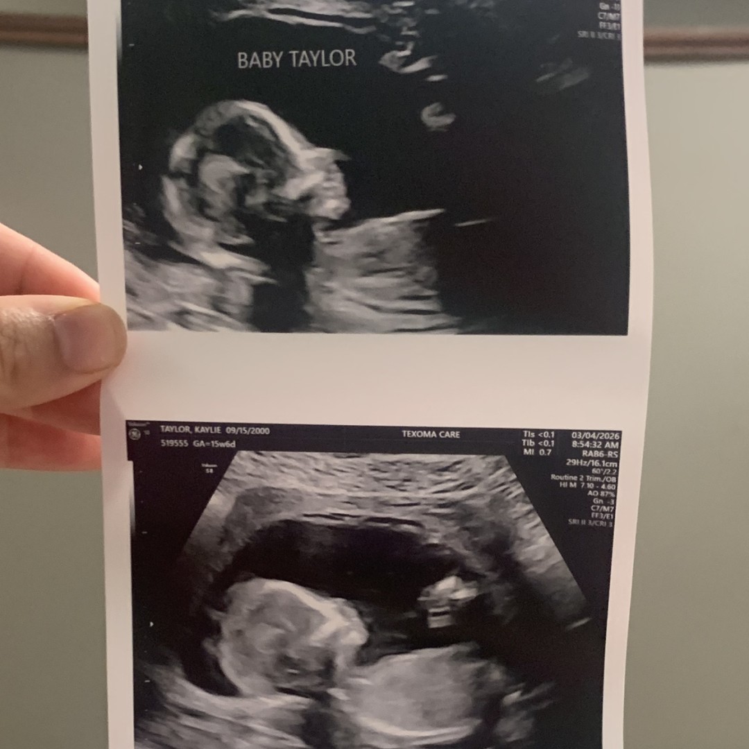 Photo shared by Kaylie for their Babylist baby registry.