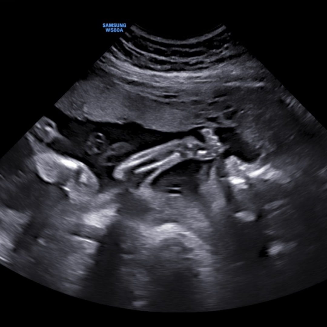 Photo shared by Crysta for their Babylist baby registry.