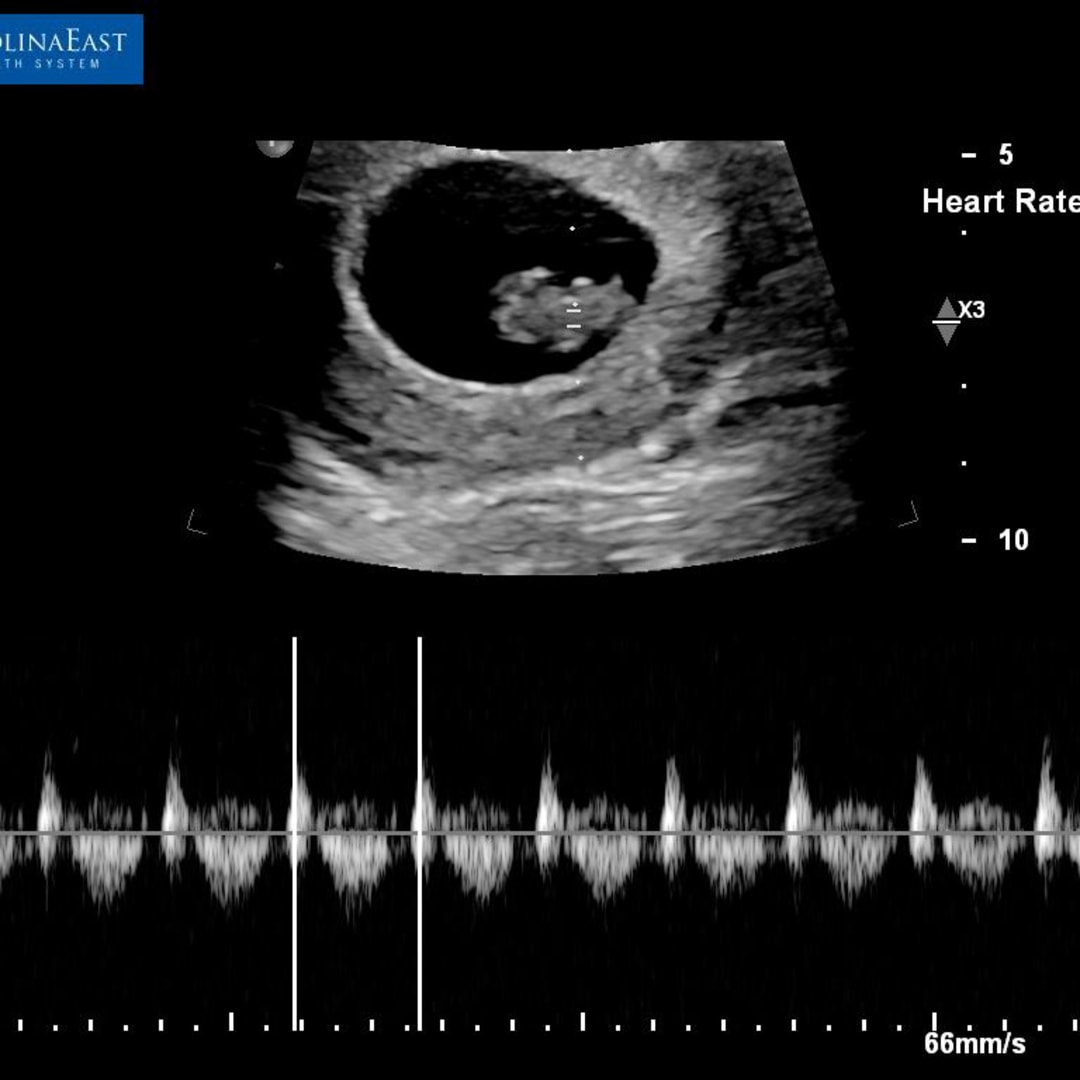 Photo shared by Kinder for their Babylist baby registry.