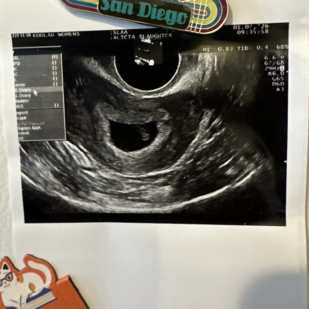 Photo shared by Jade for their Babylist baby registry.