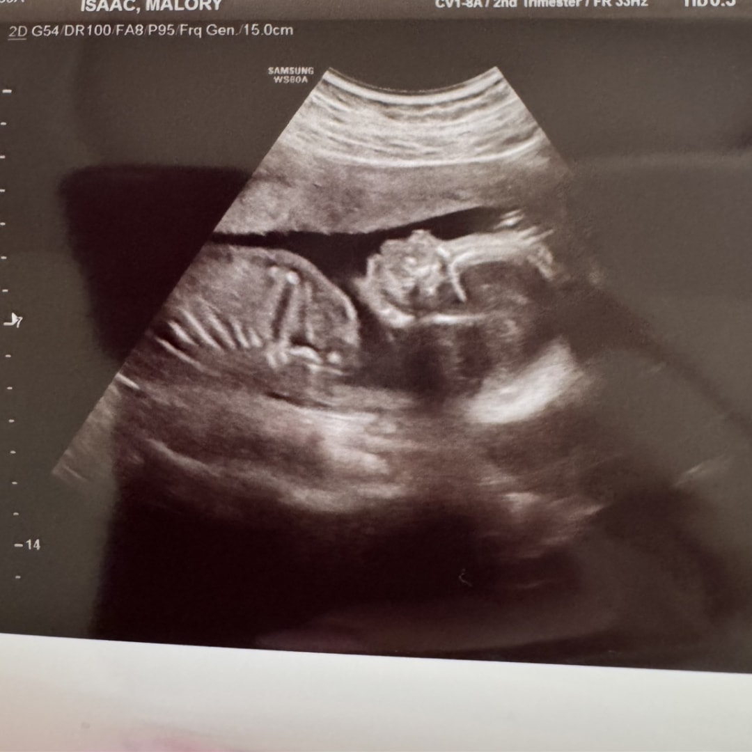 Photo shared by Malory for their Babylist baby registry.