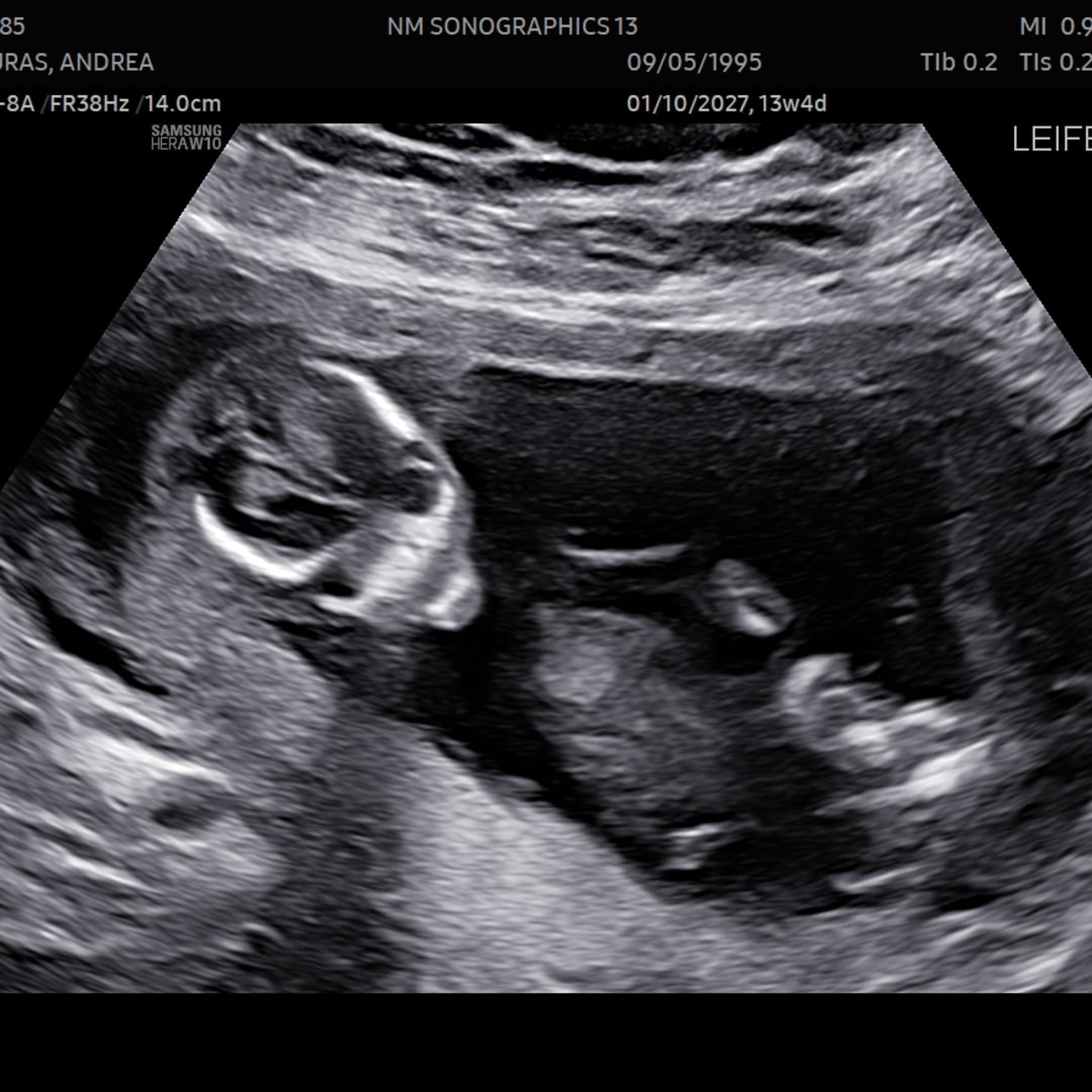 Photo shared by Andrea for their Babylist baby registry.