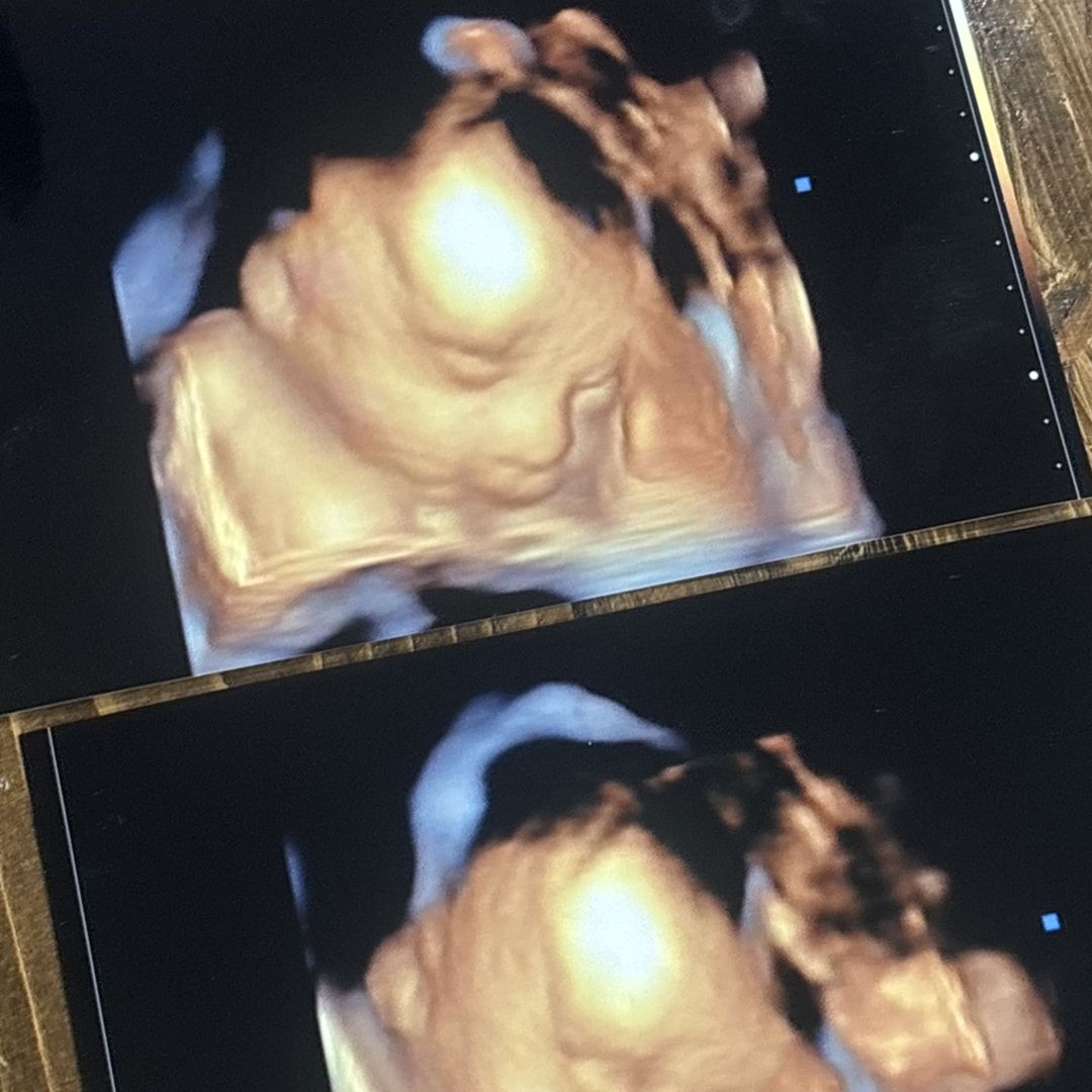 Photo shared by Caroline for their Babylist baby registry.