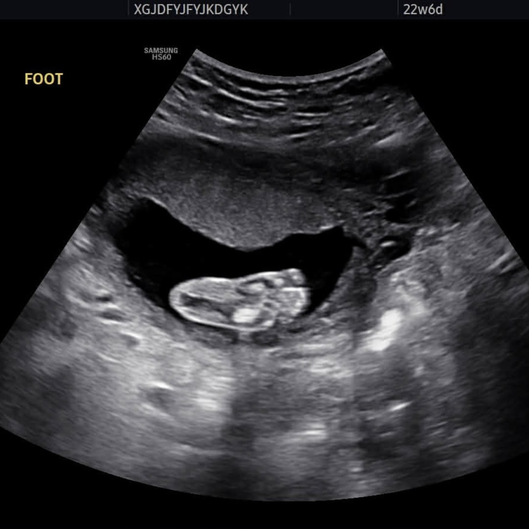 Photo shared by Adisyn for their Babylist baby registry.
