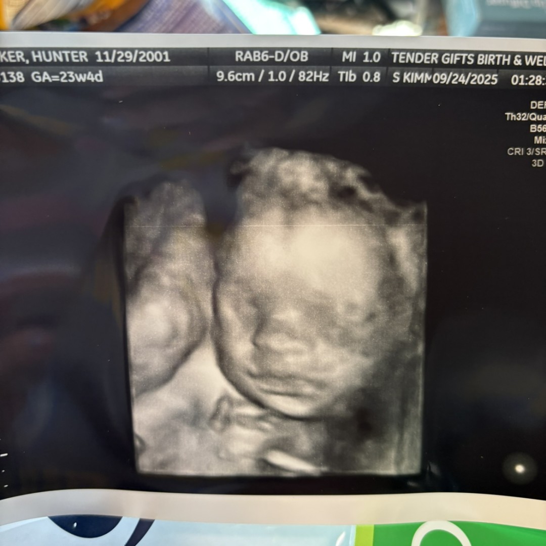 Photo shared by Hunter for their Babylist baby registry.