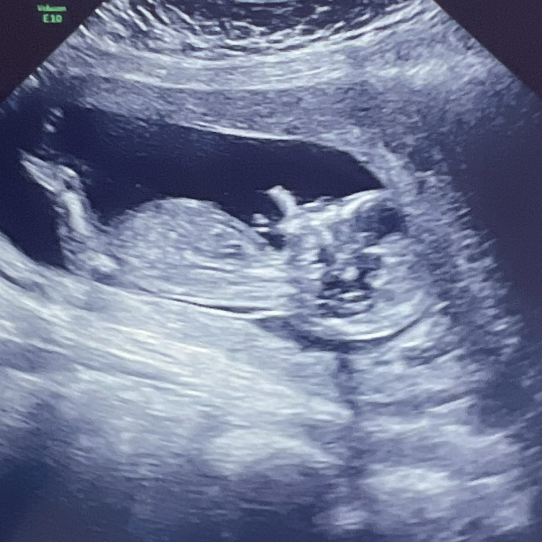 Photo shared by Arely for their Babylist baby registry.