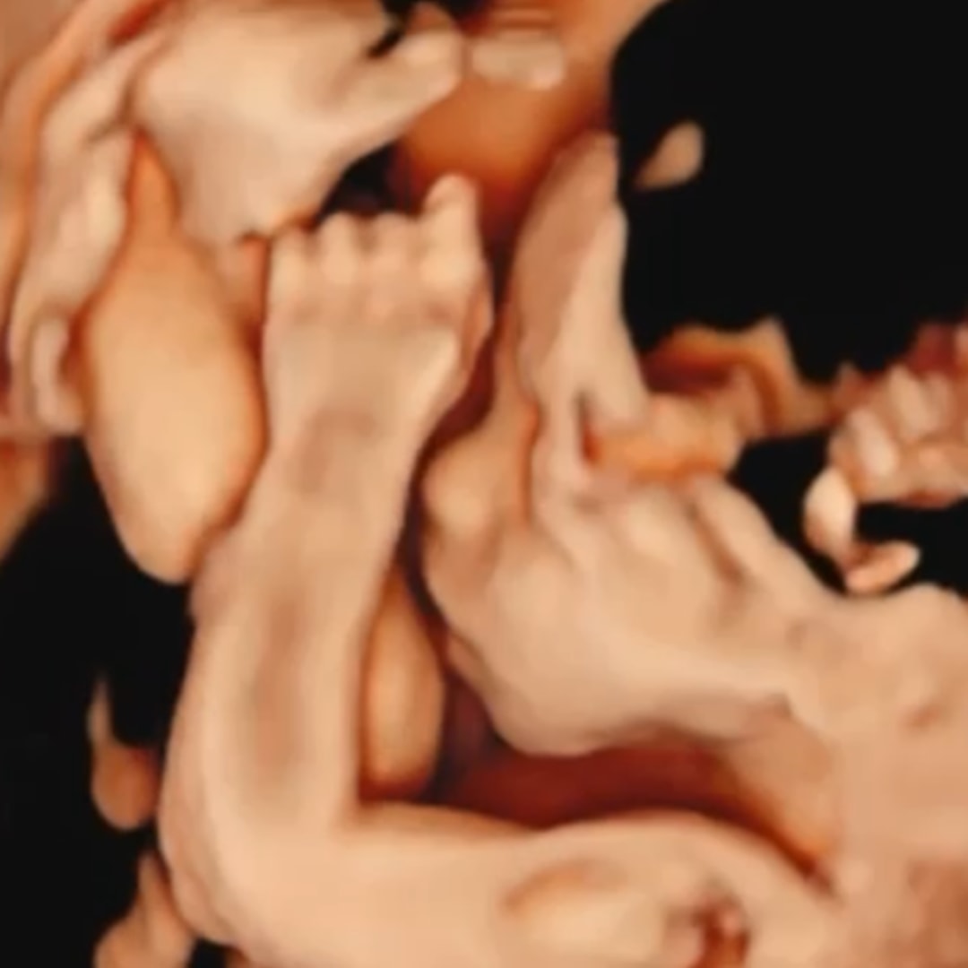 Photo shared by Theresa for their Babylist baby registry.