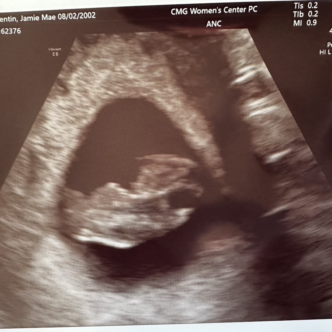 Photo shared by Jamie for their Babylist baby registry.