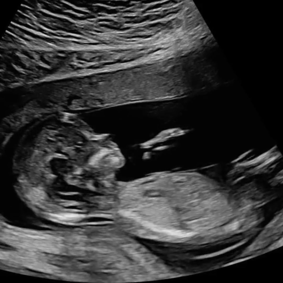 Photo shared by Emely for their Babylist baby registry.