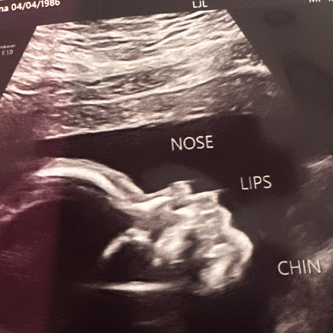Photo shared by Vanessa & Omar for their Babylist baby registry.