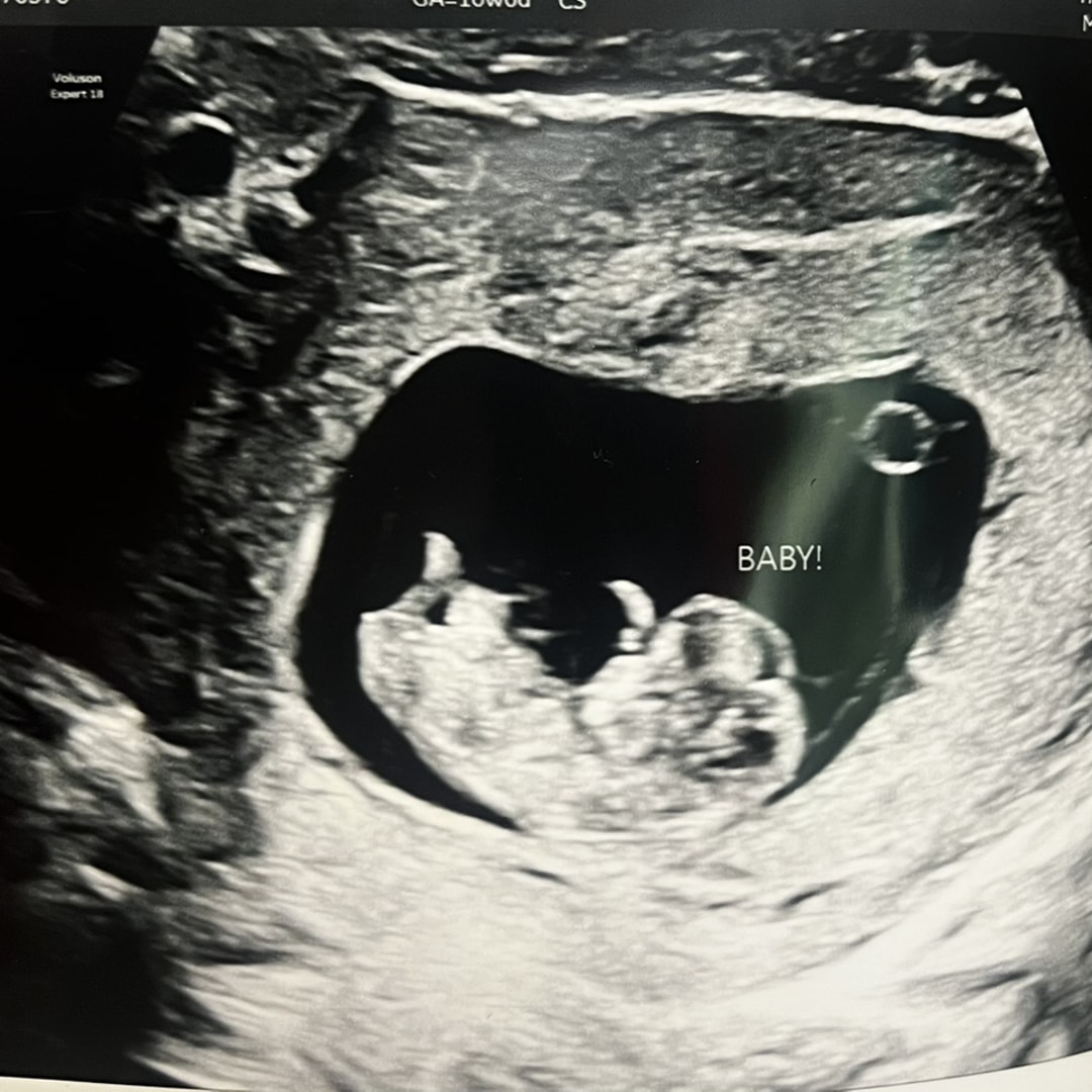 Photo shared by Janashia for their Babylist baby registry.