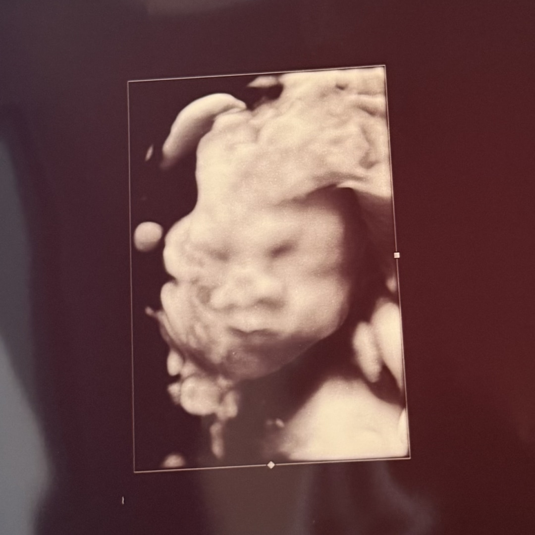 Photo shared by Bernadette for their Babylist baby registry.