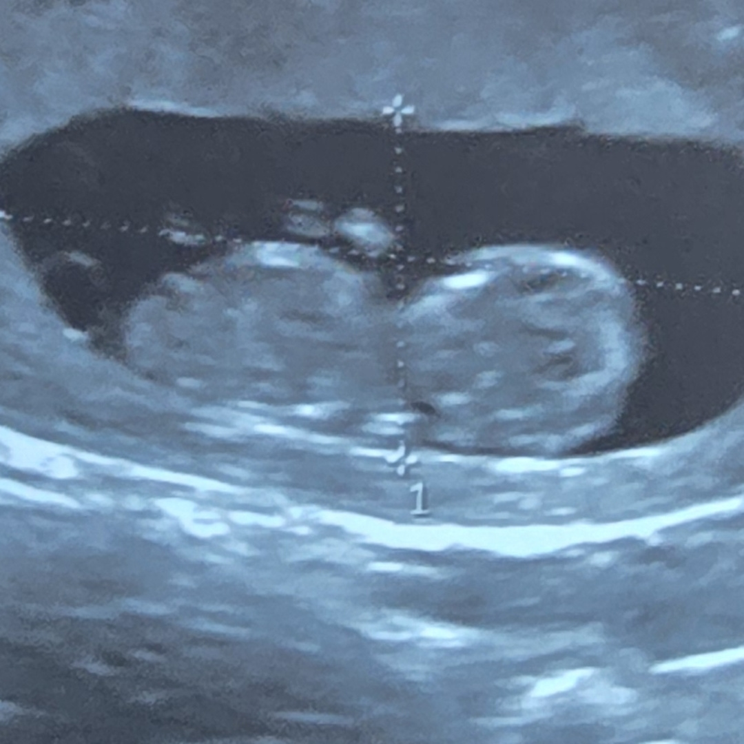 Photo shared by Jamie for their Babylist baby registry.