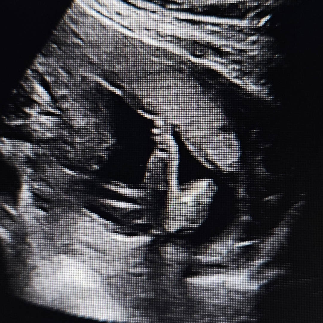 Photo shared by Alyssa for their Babylist baby registry.