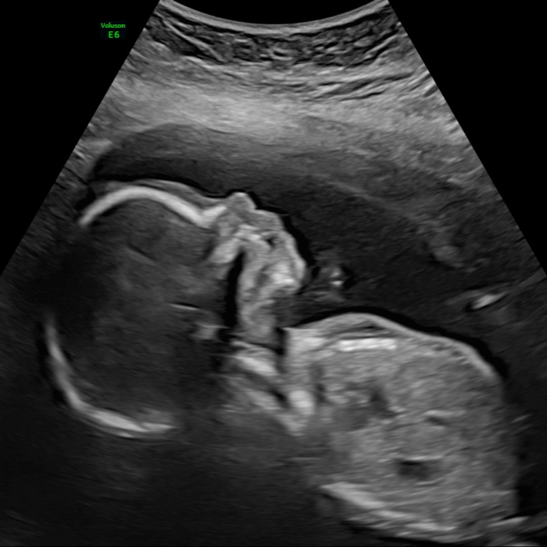 Photo shared by Michelle for their Babylist baby registry.