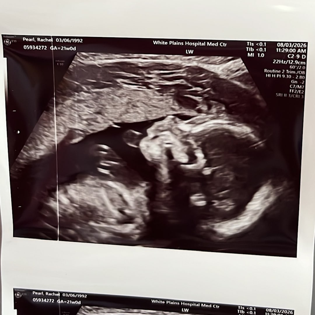 Photo shared by Rachel for their Babylist baby registry.