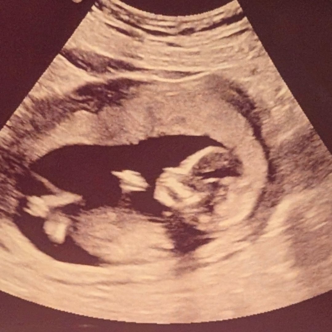 Photo shared by Ariane for their Babylist baby registry.