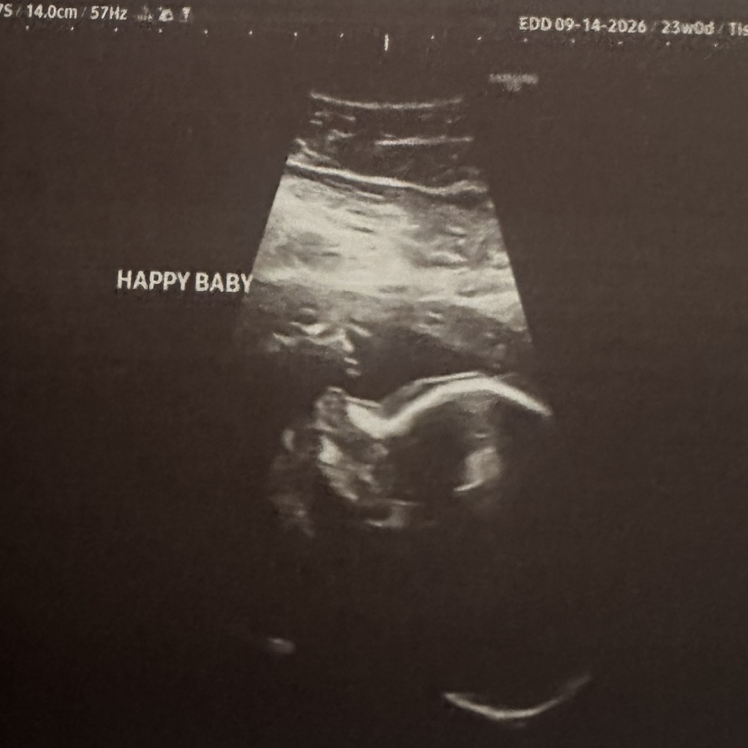 Photo shared by Allie for their Babylist baby registry.