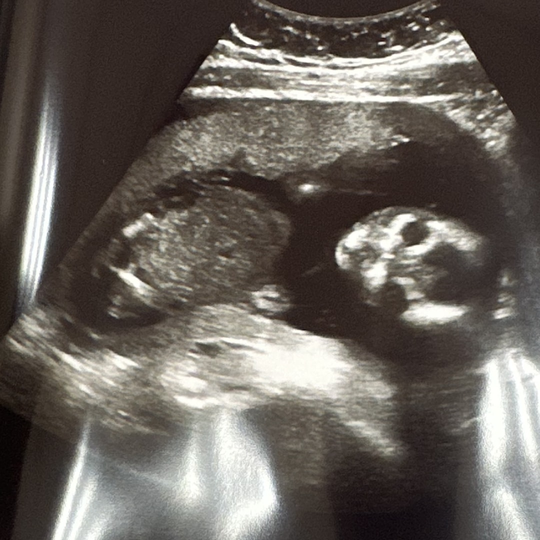 Photo shared by Alexias for their Babylist baby registry.