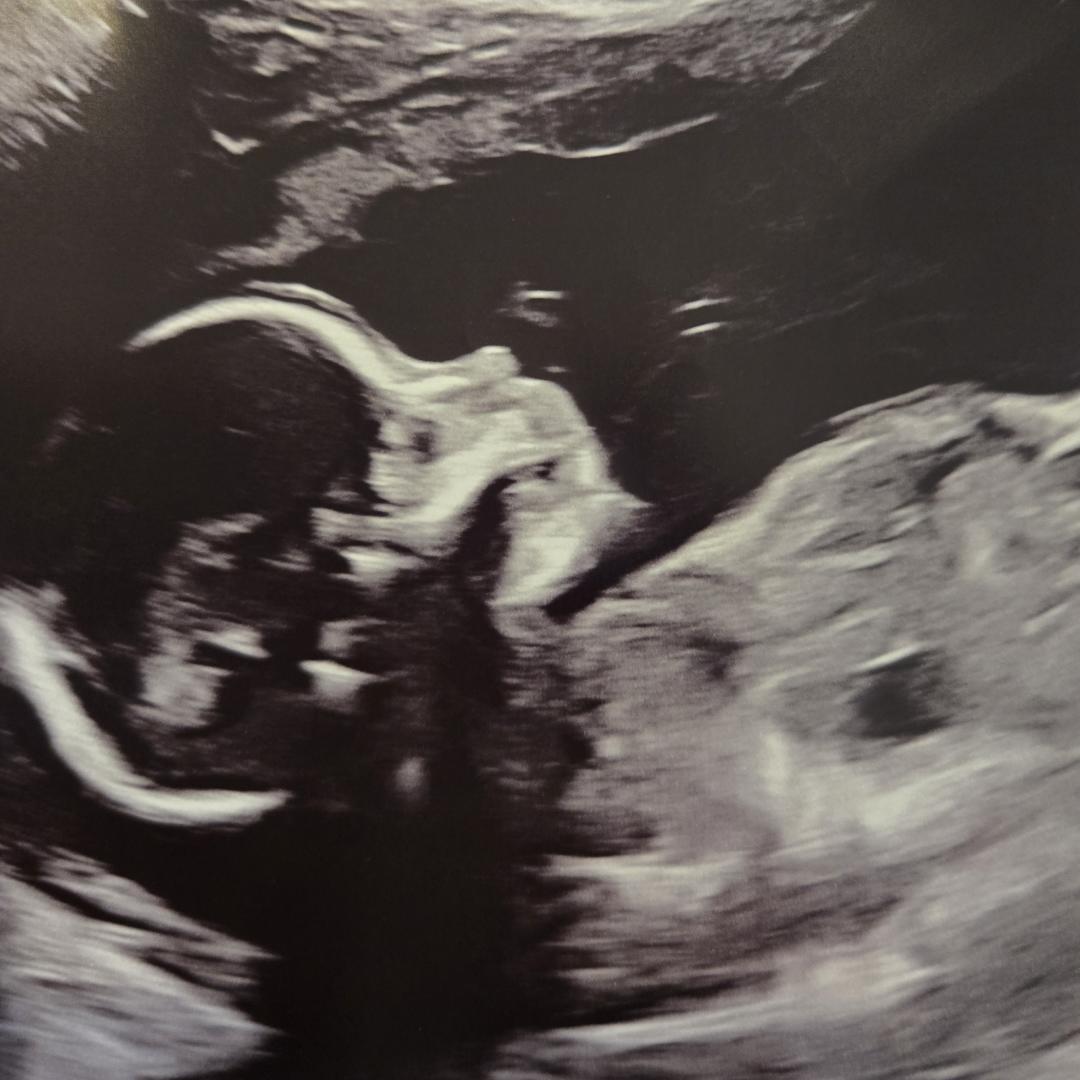 Photo shared by Denise for their Babylist baby registry.