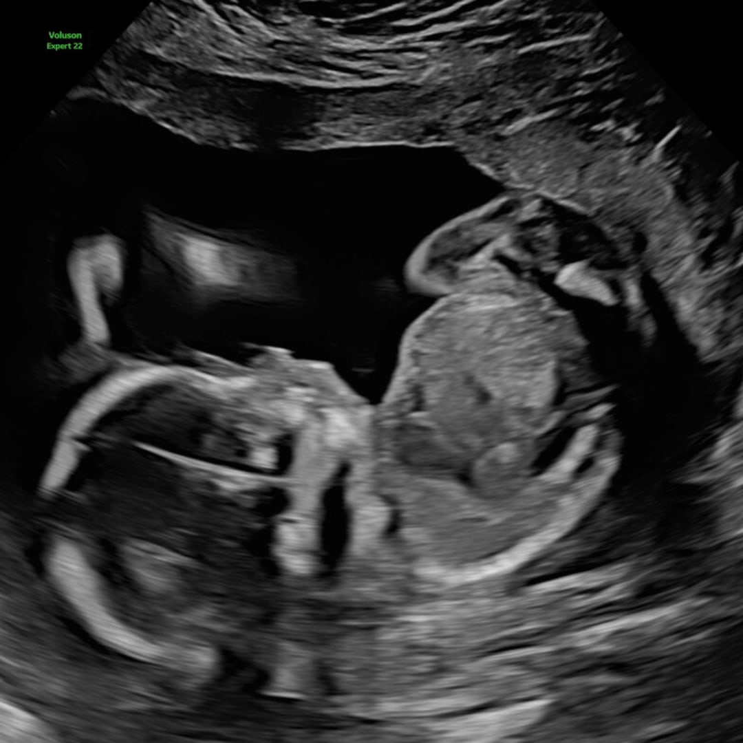 Photo shared by Carmen for their Babylist baby registry.
