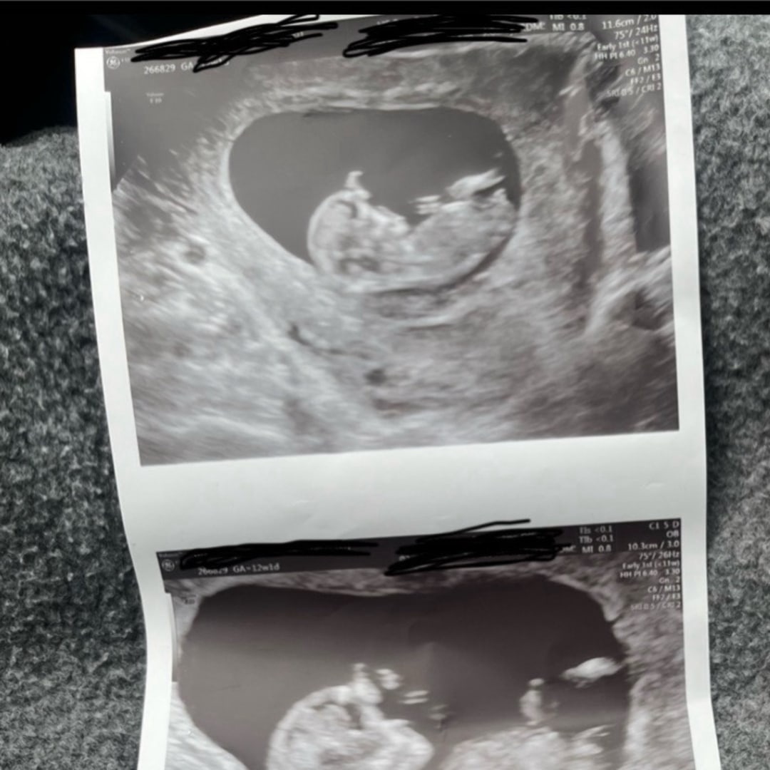 Photo shared by Antoenesha for their Babylist baby registry.