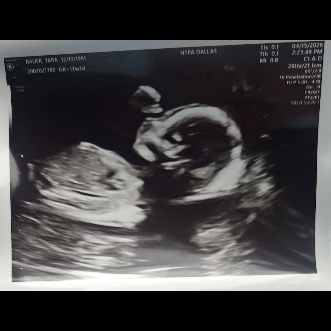 Photo shared by Tara for their Babylist baby registry.