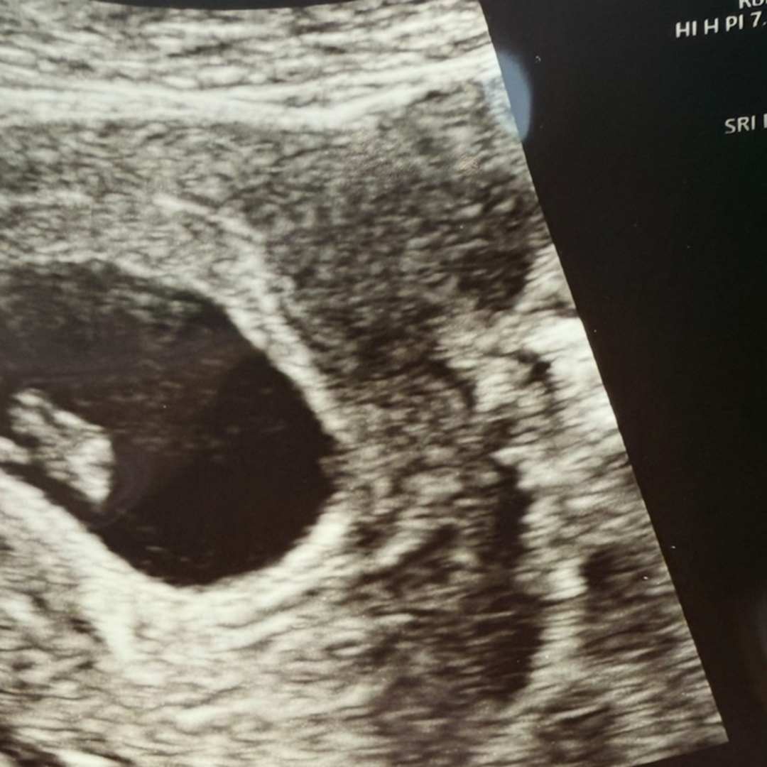 Photo shared by Desirea for their Babylist baby registry.