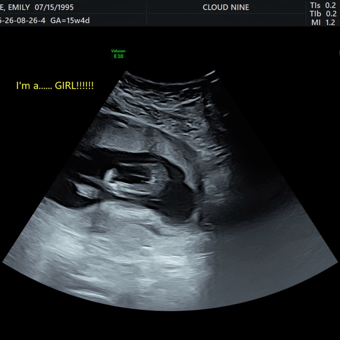Photo shared by Emily for their Babylist baby registry.