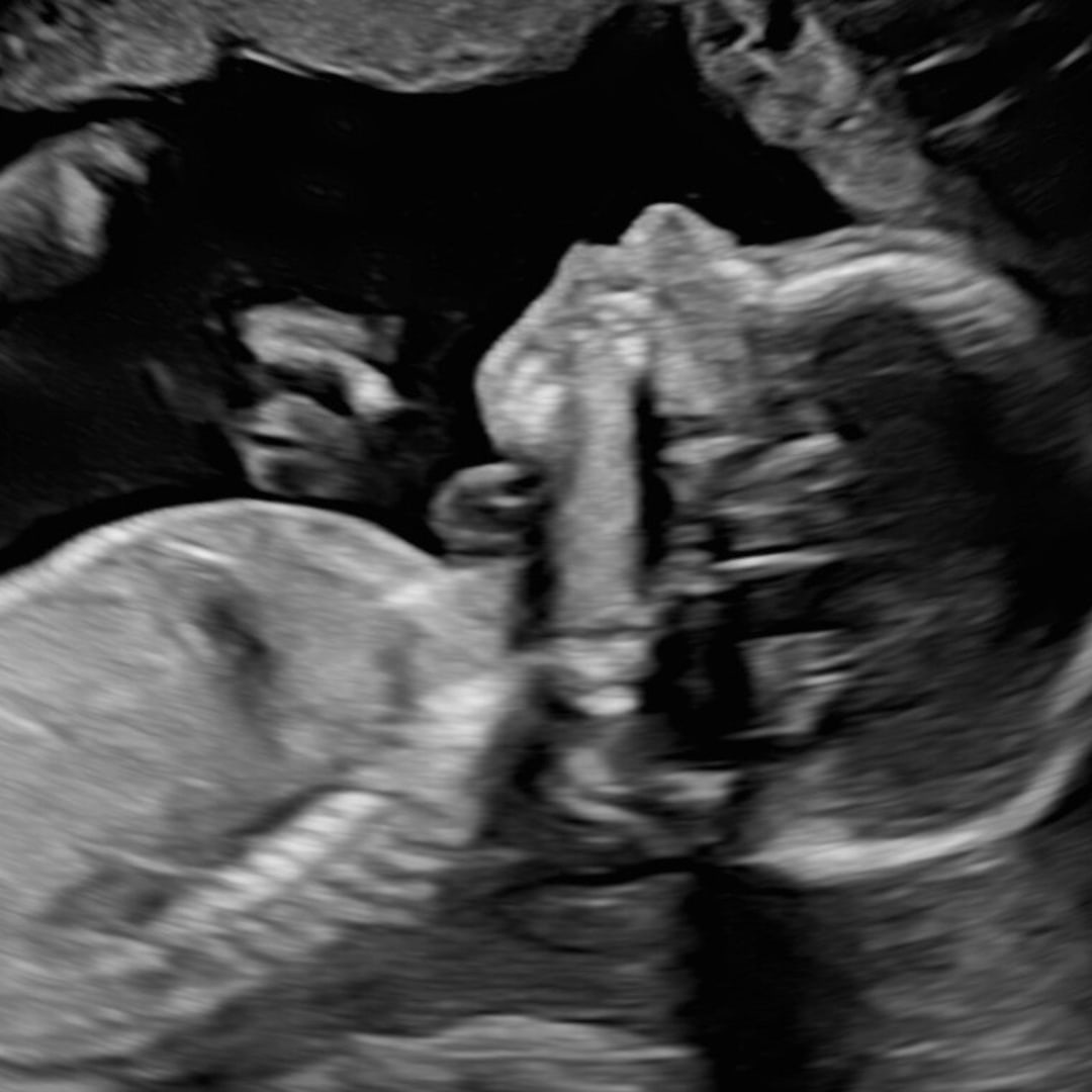 Photo shared by Abbie for their Babylist baby registry.