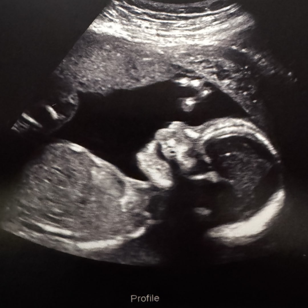 Photo shared by Ashley for their Babylist baby registry.