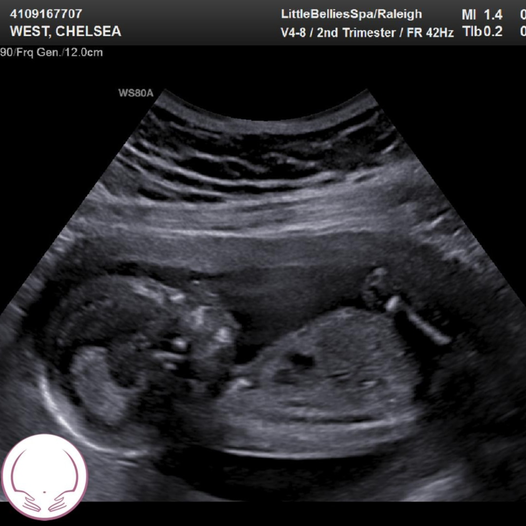 Photo shared by Chelsea for their Babylist baby registry.