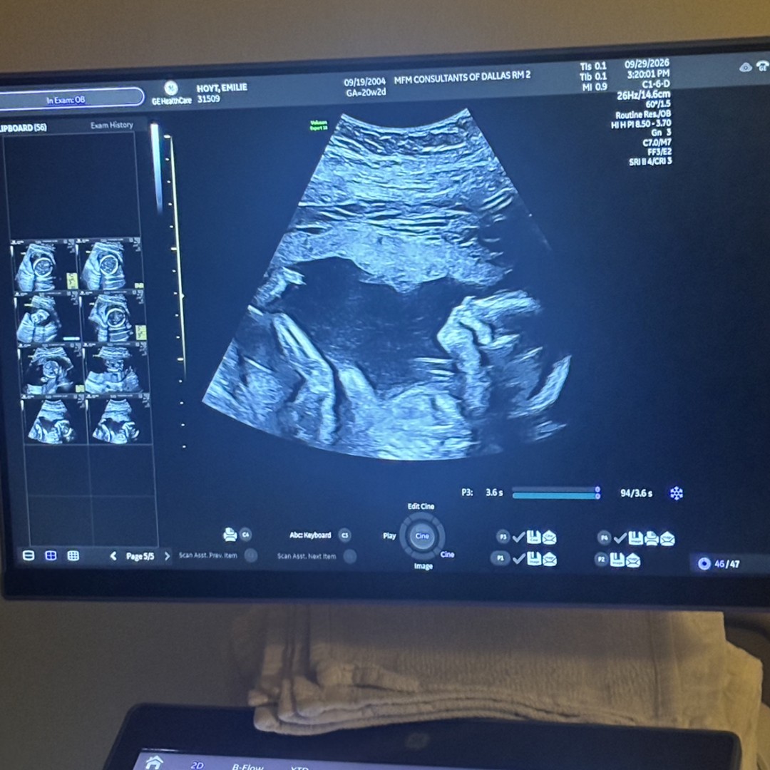 Photo shared by Emilie for their Babylist baby registry.