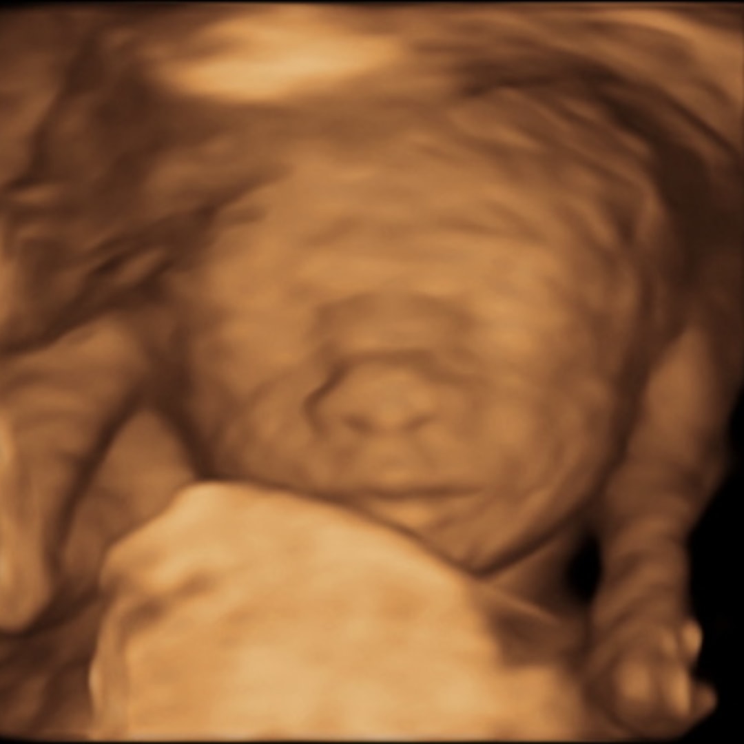 Photo shared by Lexi for their Babylist baby registry.