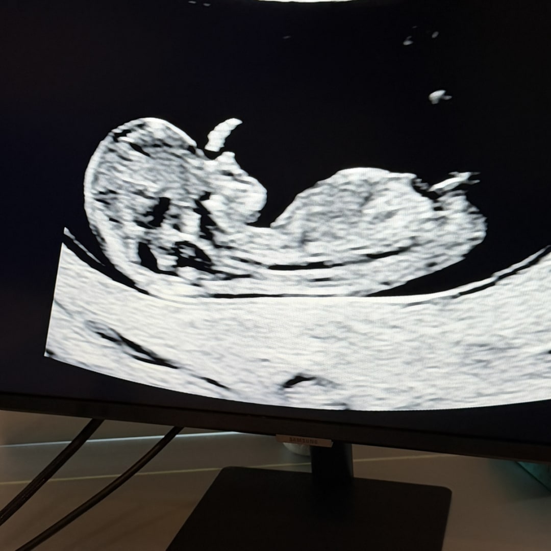 Photo shared by Kaitlin for their Babylist baby registry.