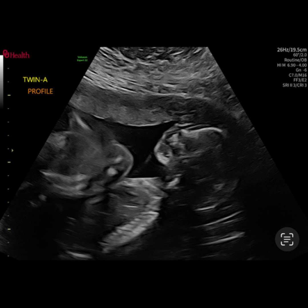 Photo shared by Teagan for their Babylist baby registry.