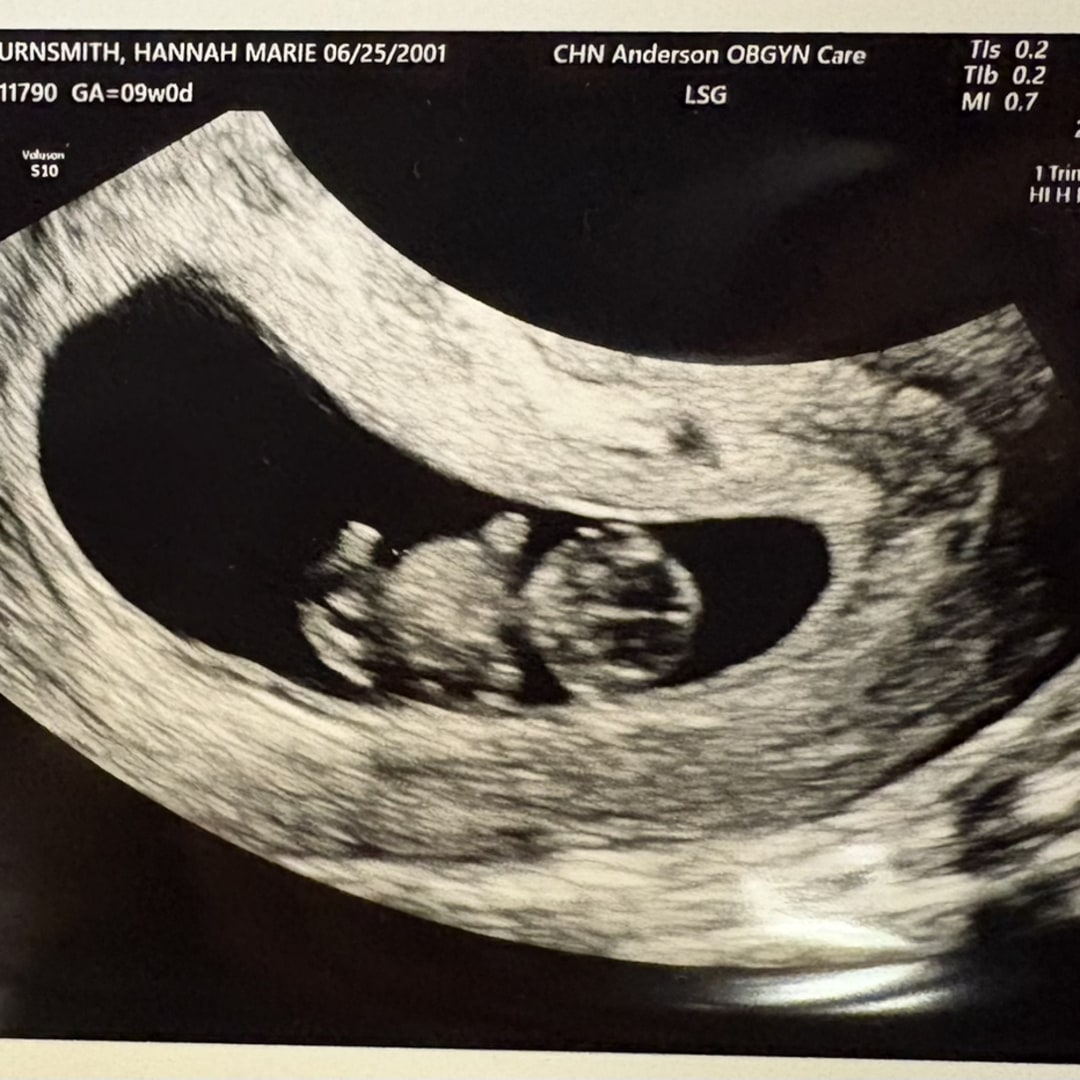 Photo shared by Hannah for their Babylist baby registry.