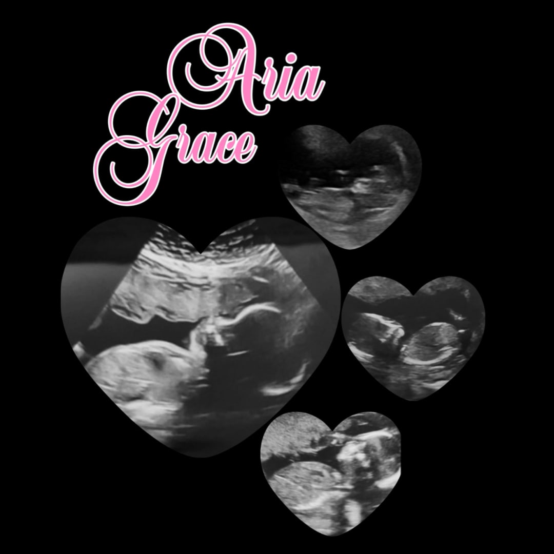 Photo shared by Catty & Andrew for their Babylist baby registry.