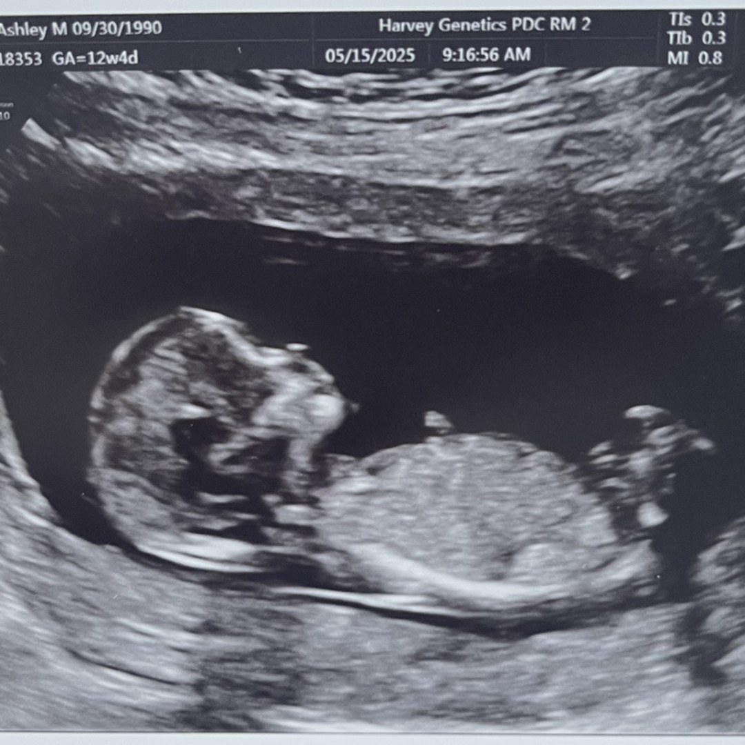 Photo shared by Ashley for their Babylist baby registry.