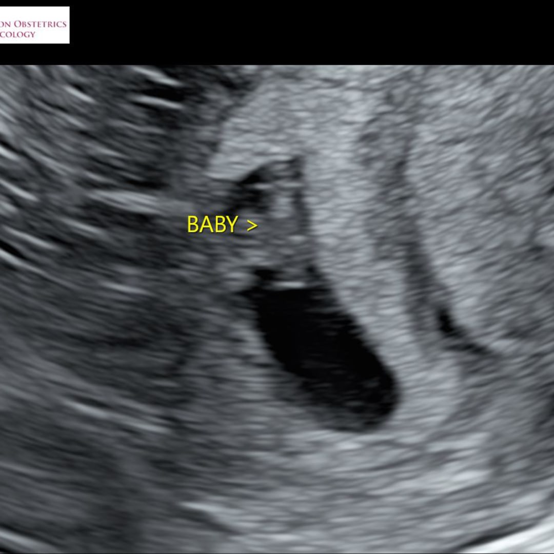 Photo shared by Kimberly for their Babylist baby registry.