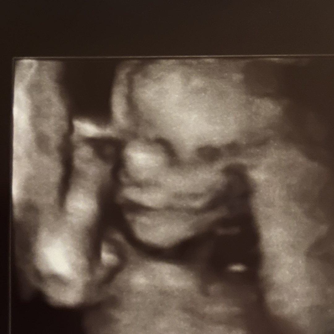 Photo shared by Kara for their Babylist baby registry.