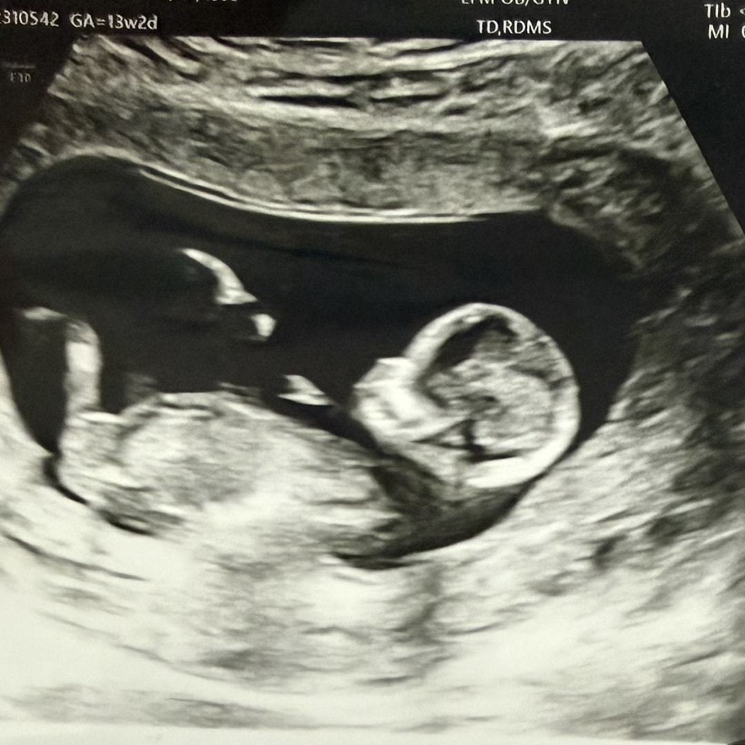 Photo shared by Indra for their Babylist baby registry.