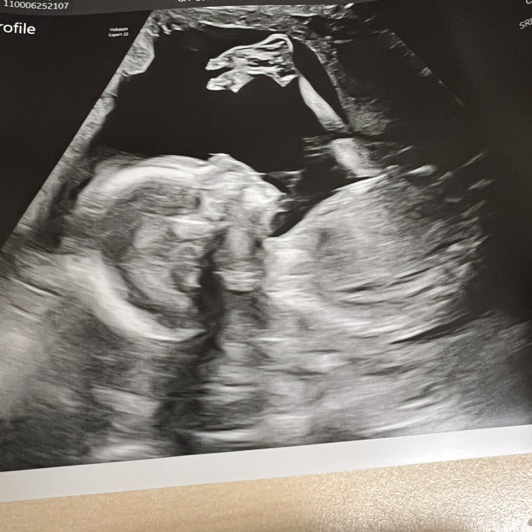 Photo shared by Heather for their Babylist baby registry.