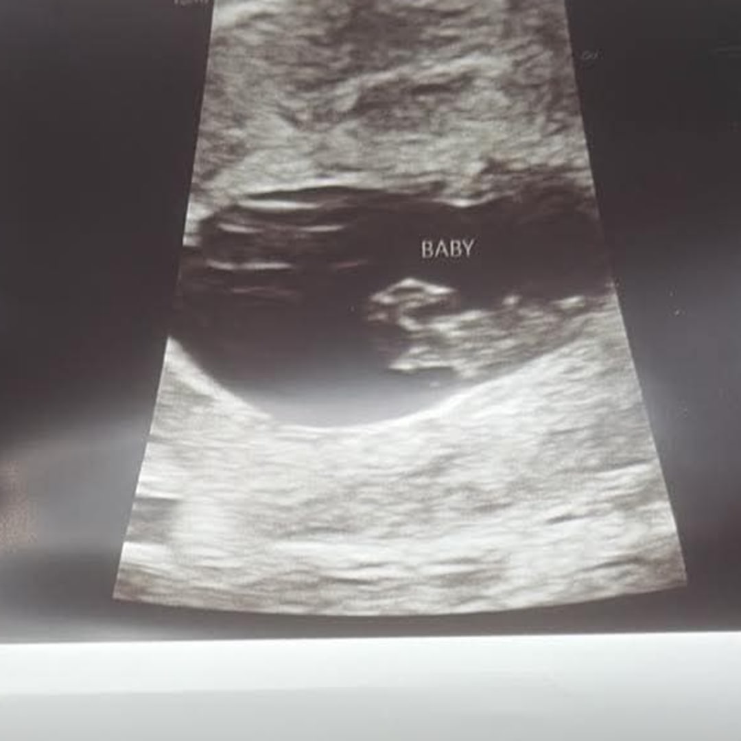 Photo shared by AshLynn for their Babylist baby registry.