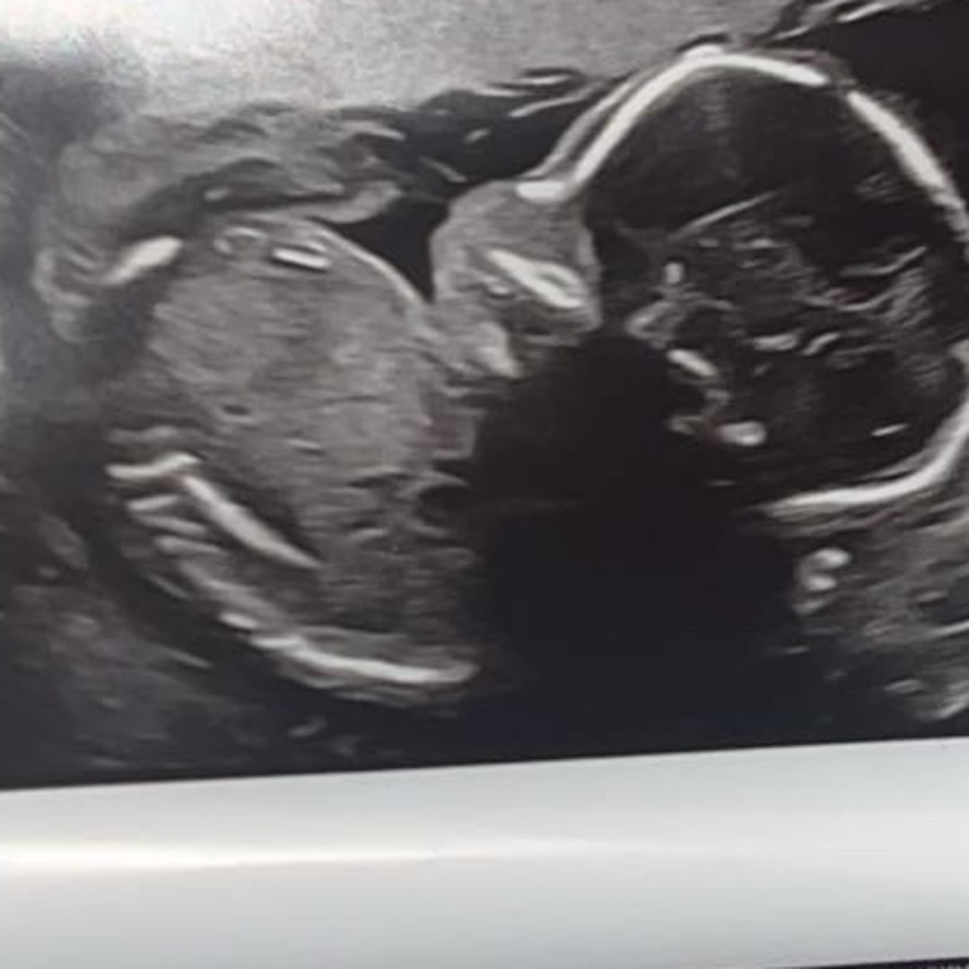Photo shared by Alejandra for their Babylist baby registry.