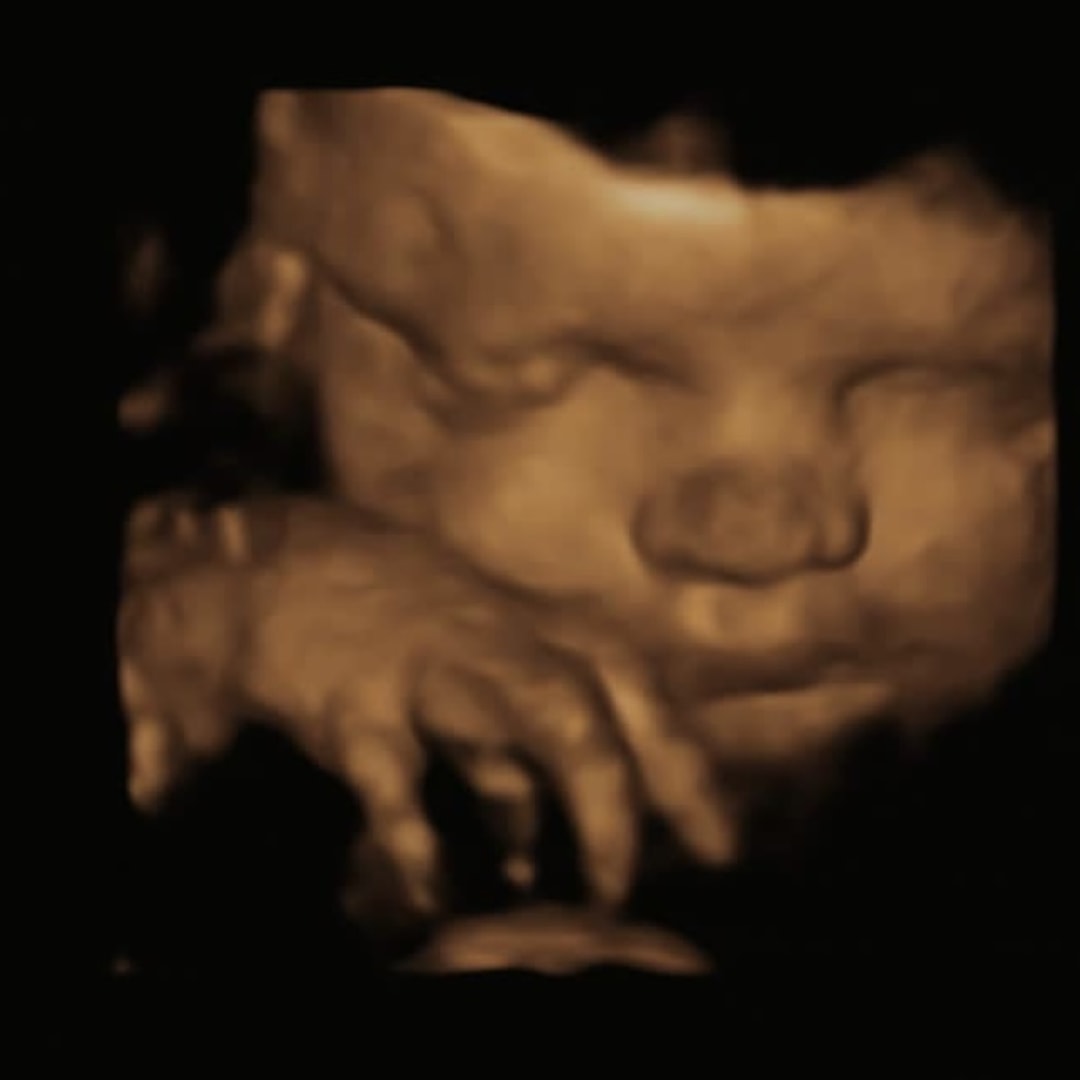 Photo shared by Cheyenne for their Babylist baby registry.