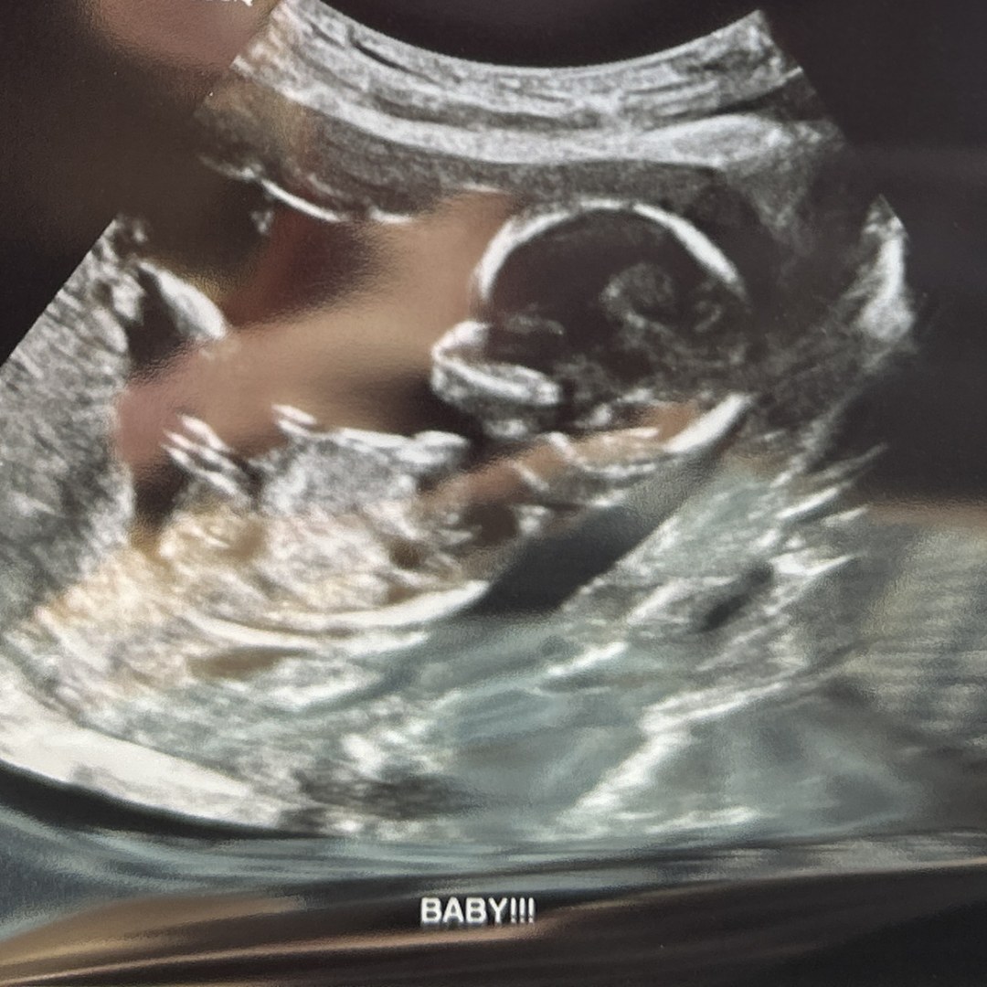 Photo shared by Julia for their Babylist baby registry.
