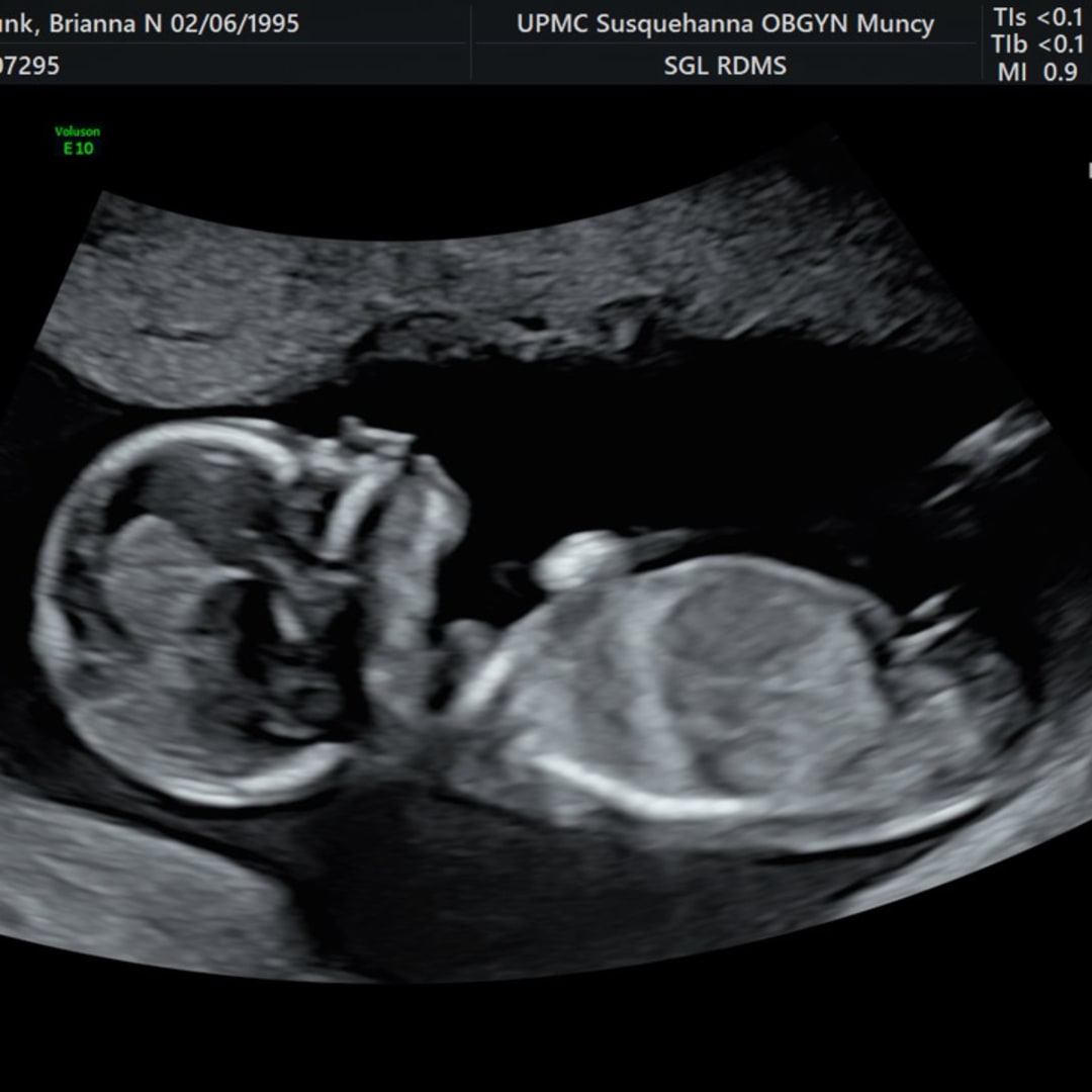 Photo shared by Brianna for their Babylist baby registry.