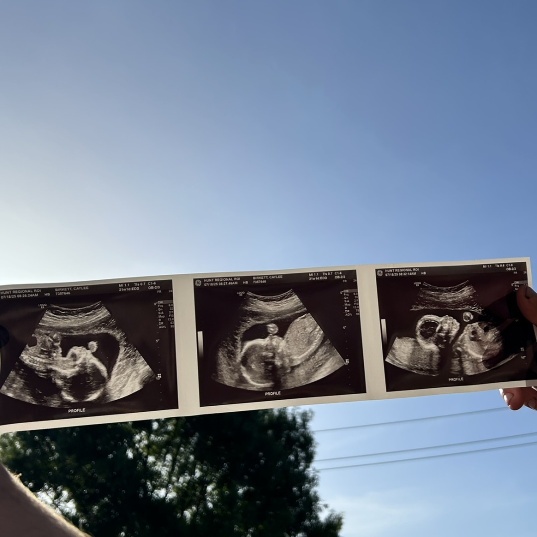 Photo shared by Caylee for their Babylist baby registry.